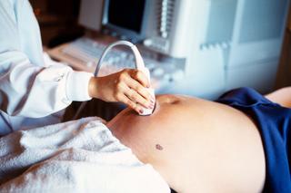 Wady budowy macicy a ciąża. Czy ciąża z wadą macicy zawsze jest zagrożona?