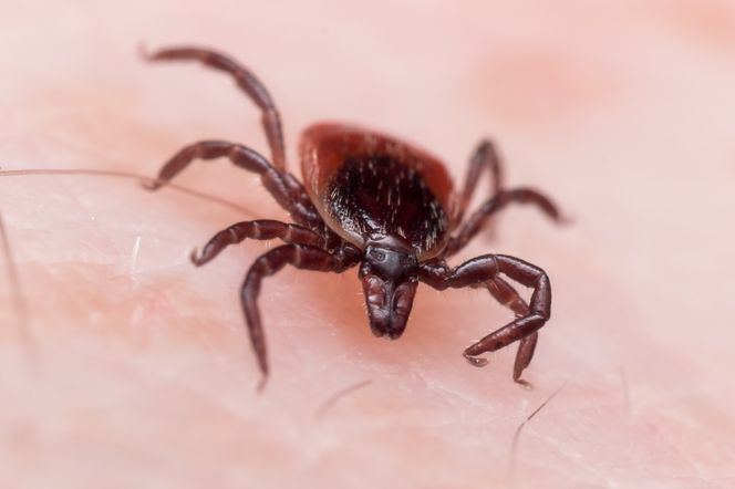 KLESZCZOWE ZAPALENIE MÓZGU: objawy i leczenie, powikłania