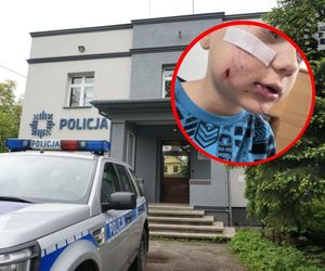 Właścicielowi psa, który pogryzł dziecko grozi nawet więzienie