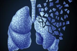 Pojemność płuc zmniejsza się po 40. roku życia