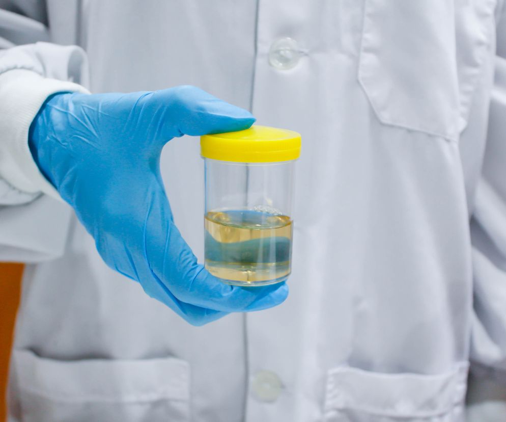 Przezroczysty, spieniony, mętny - kiedy mocz powinien zaniepokoić?