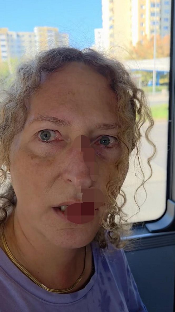Zenobia broniła Ukrainki w autobusie w Warszawie. Została zaatakowana. „Krew polała się z nosa”
