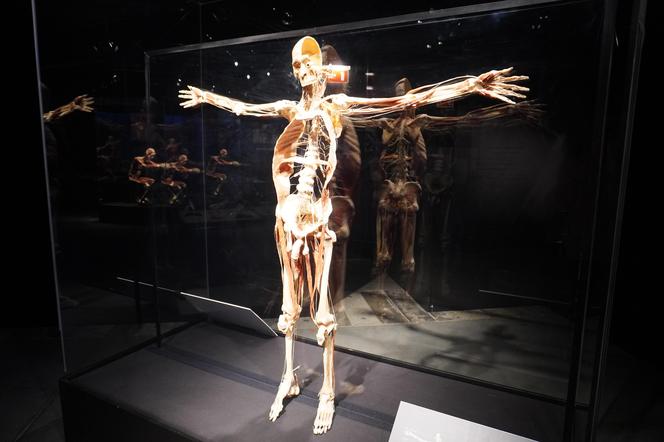 Wystawa z ludzkiego ciała. Body Worlds powróciła do Gdańska po 5 latach 