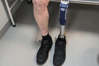 Najstarszy pacjent w Polsce z ultranowoczesną protezą wróci do pracy w ogrodzie 