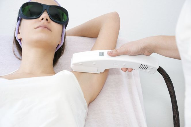 DEPILACJA LASEROWA - co musisz wiedzieć, zanim wybierzesz się na zabieg