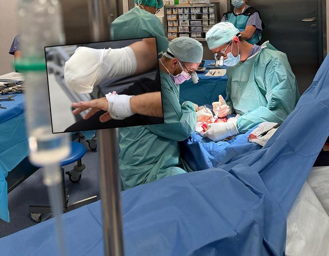 Lekarze z 5 Wojskowego Szpitala Klinicznego w Krakowie przyszyli oderwany kciuk panu Wojciechowi