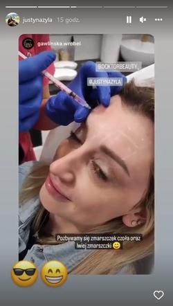 Justyna Żyła ingerowała w swój wygląd