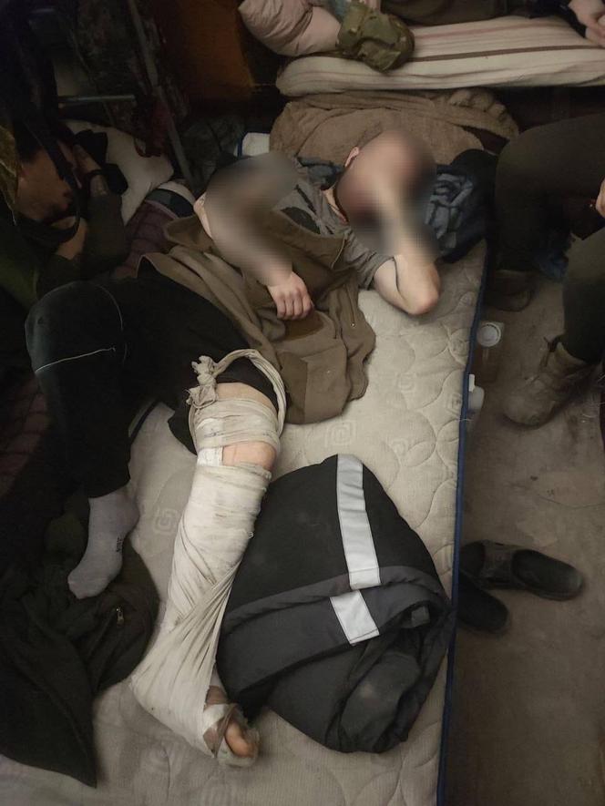 Wstrząsające zdjęcia ze szpitala polowego w Azowstalu. "Potrzebna natychmiastowa ewakuacja"