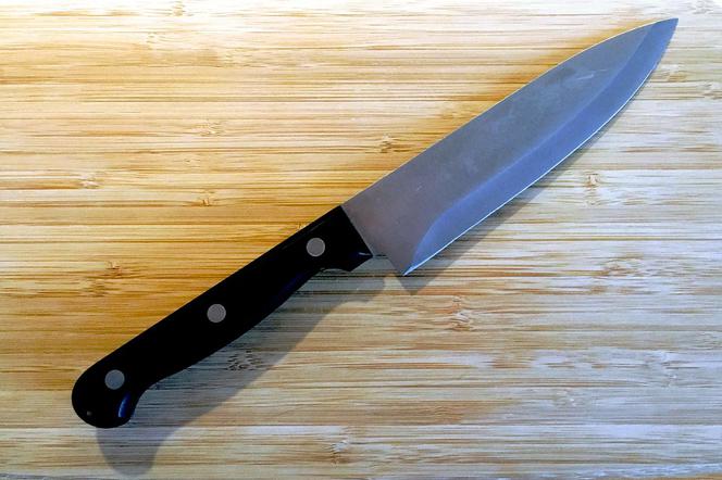 Dramat w punkcie gastronomicznym. 19-latek wbił sobie nóż w szyję