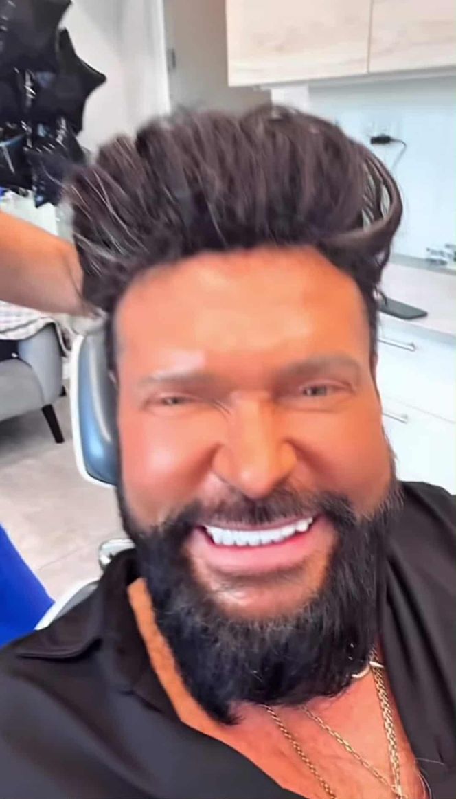 Krzysztof Rutkowski i jego nowe zęby. Zdania fanów? Podzielone