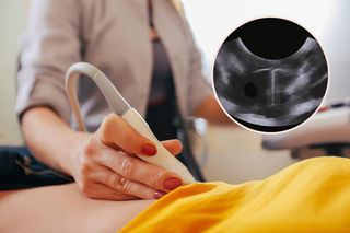 4 miesiące po porodzie na USG zobaczyła spiralę. Drugie badanie ujawniło prawdę: „Totalny szok”
