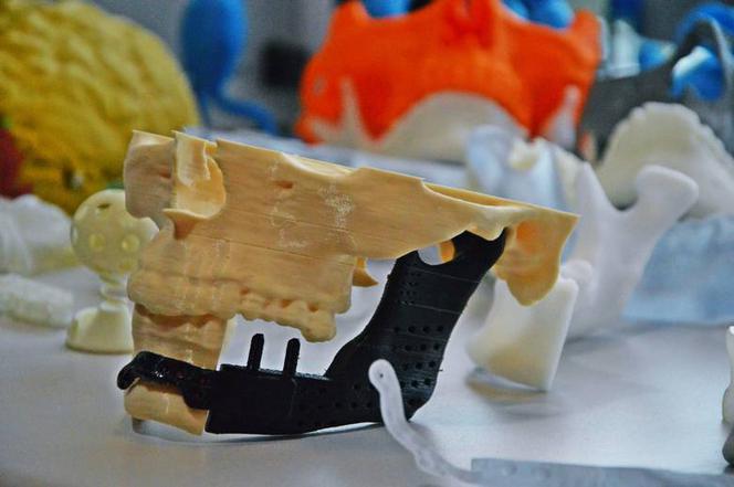 Wydrukowali mu nowe kości twarzy