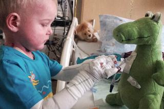 Moja skóra mnie zabija