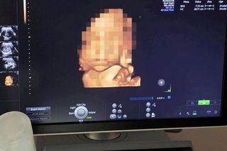 Bruno miał dziś przyjść na świat. Wypadek samochodowy ciężarnej Patrycji w Katowicach