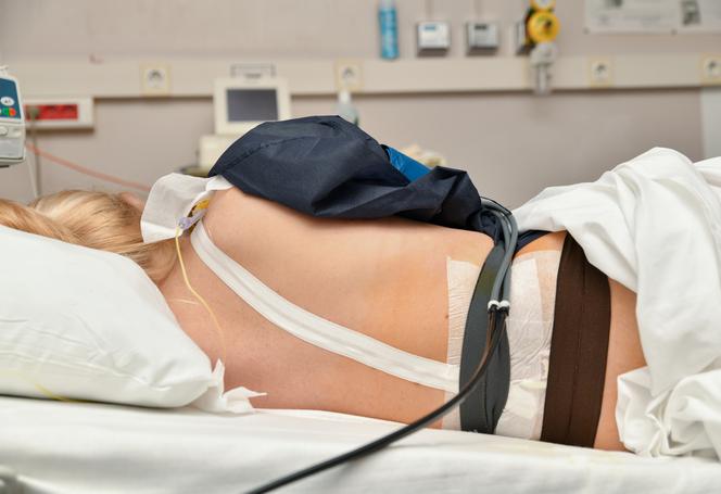 Obalamy mity dotyczące znieczulenia zewnatrzoponowego podczas porodu