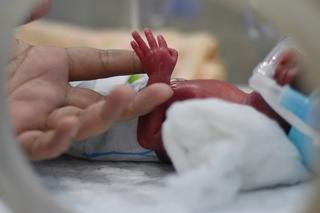 Po urodzeniu lekarze dawali jej nikłe szanse. Pokazała, że ma ogromną wolę życia