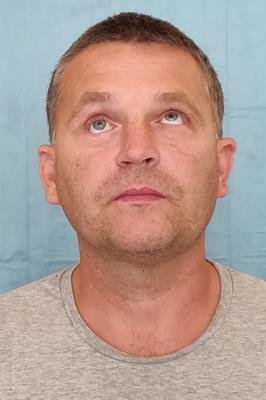 Wydrukowali mu nowe kości twarzy