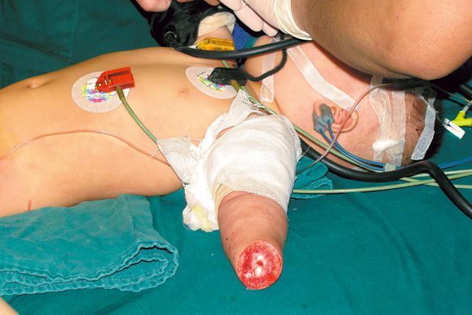 Babcia obcięła wnuczce rączki!