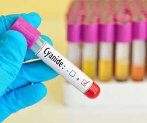 Cyjanek - legalna trucizna. Zatrucie cyjankiem: objawy, odtrutka