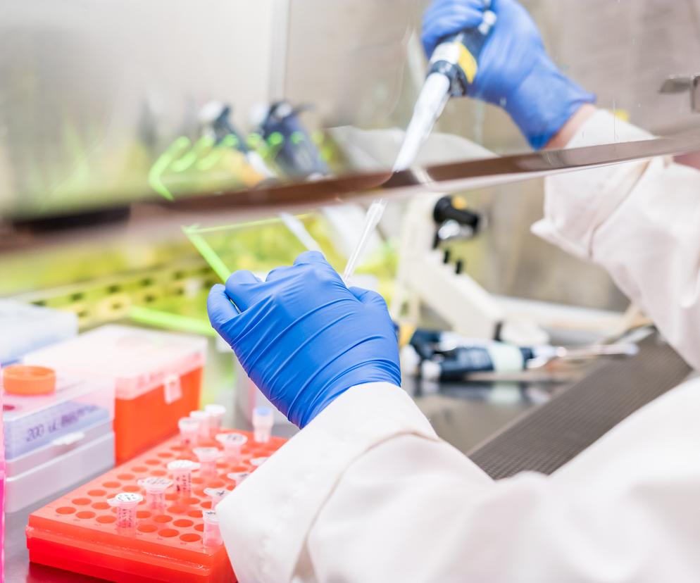 Wirus małpiej ospy wykryty na przedmiotach. Badacze wyjaśniają, czy można się zarazić