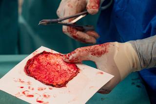 Samodzielny Publiczny Szpital Kliniczny Nr 2 PUM w Szczecinie