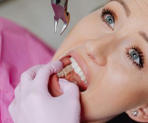 Pacjenci uwierzyli w 600+ na dentystę. Lekarze obalają mity. Prawda może zaboleć bardziej niż chory ząb