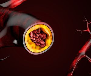 Cholesterol LDL - czym jest? Badanie i normy