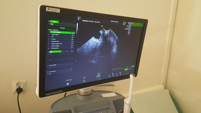 Nowoczesny sprzęt w czeladzkim szpitalu