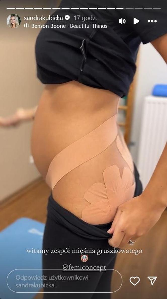 Sandra Kubicka poddała się tapingowi w ciąży