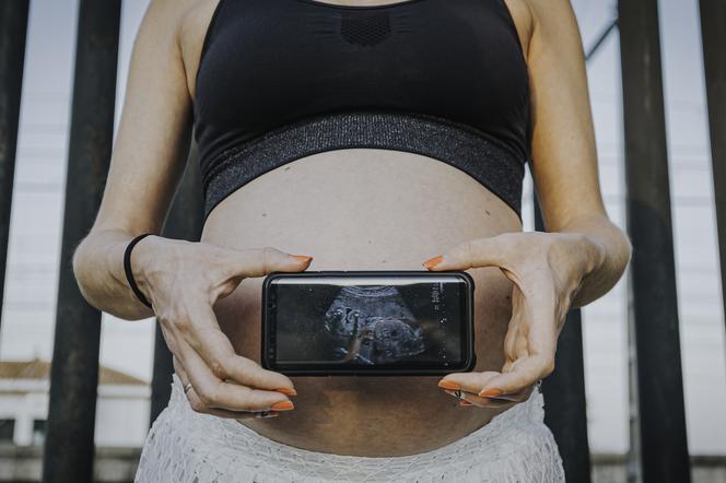 kobieta ze zdjęciem USG ciąży w telefonie 