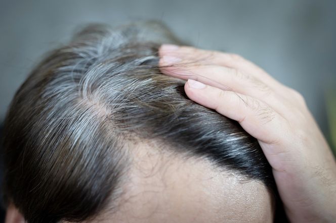 Jak się pozbyć siwych odrostów raz-dwa? Fryzjer zdradza niezawodny trik