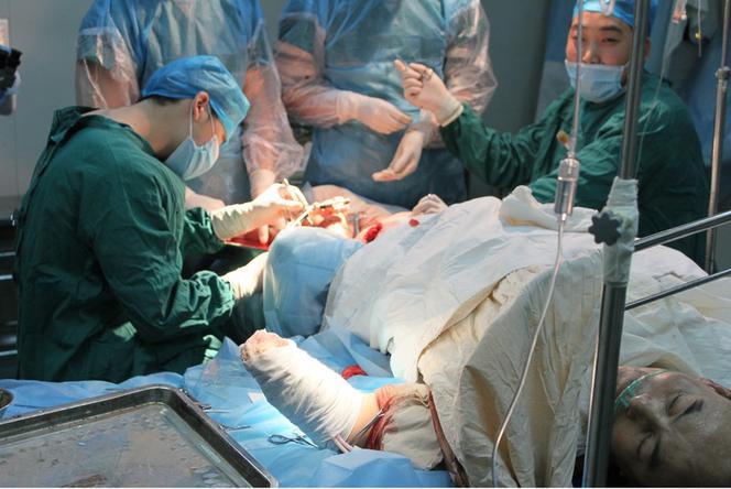 Chińscy lekarze wszyli pacjentowi dłoń w nogę