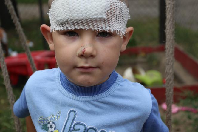 10- latek pociął nożem 5- latka