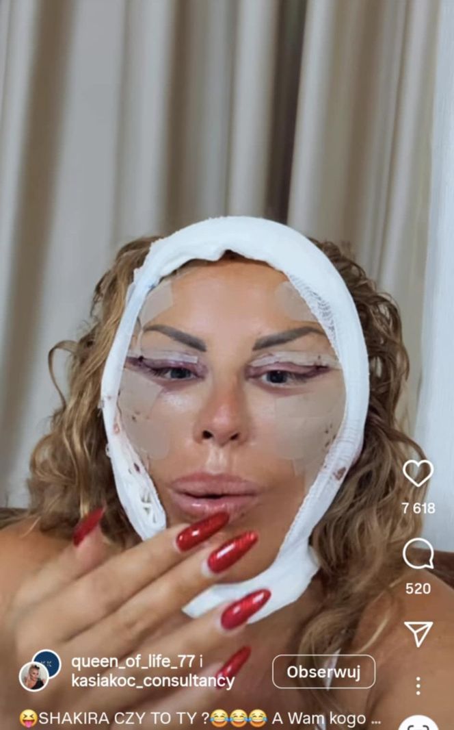 Dagmara Kaźmierska miała operację plastyczną