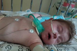 Uratujmy serduszko malutkiego Wiktorka. Pomóc może jedynie horrendalnie droga operacja