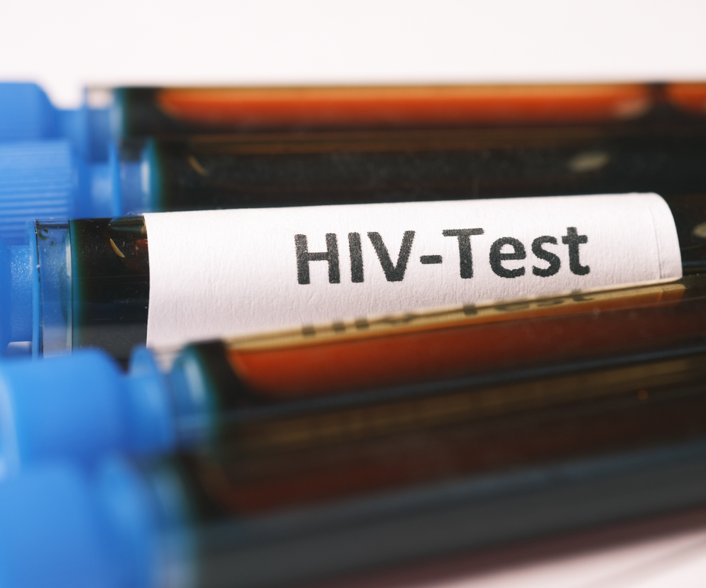test na HIV