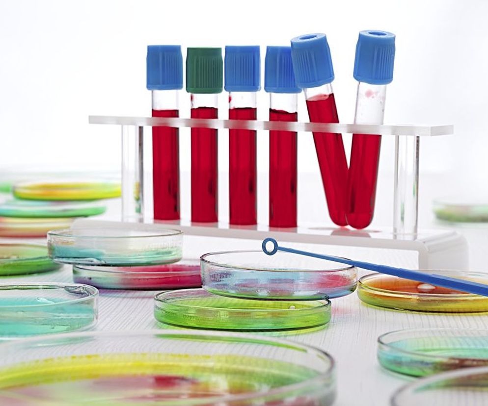By zdiagnozować  wirusowe zapalenie wątroby (WZW) typu B wykrywa się we krwi antygeny wirusa (HBsAg i  HBeAg ) oraz przeciwciała (anty-HBs, anty-HBc i anty-HBe).