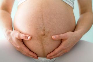 Kilka miesięcy po porodzie wciąż przypomina o ciąży. Kiedy znika linea nigra?