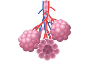Zespół Eisenmengera: przyczyny, objawy i leczenie naczyniowej choroby płuc