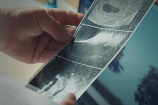 M jak miłość odc. 1843. USG ciąży Jagody 