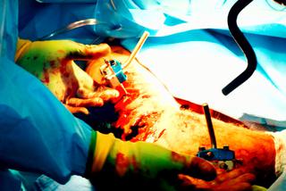 Poznajcie historię bohatera z Afganistan