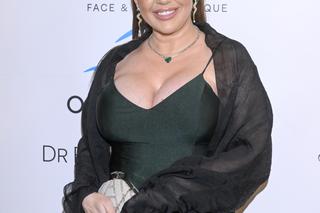 Iwona Węgrowska po operacji plastycznej. Pierwszy raz pokazała się na ściance