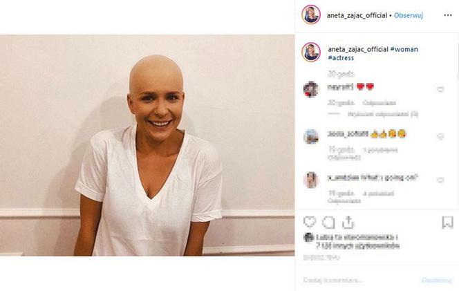 Aneta Zając pokazała swoje zdjęcie bez włosów