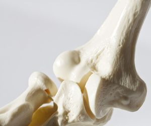 Kiedy grozi ci osteoporoza polekowa? Przyczyny i leczenie osteoporozy polekowej