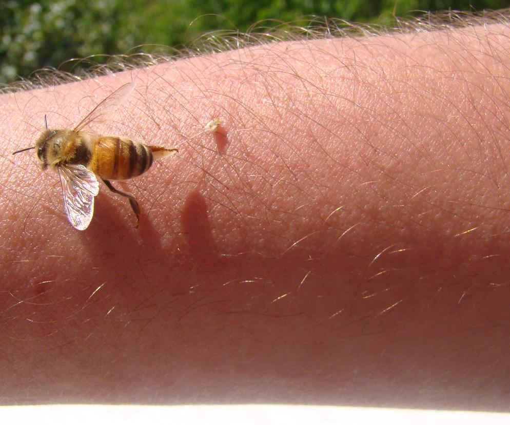 Co na użądlenie pszczoły? Najlepsze domowe sposoby