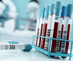 Ziarnica złośliwa czyli chłoniak Hodgkina - przyczyny, objawy, leczenie