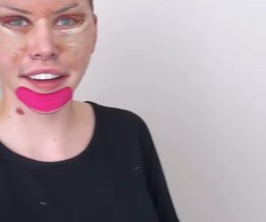 Julia Von Stein po operacji 