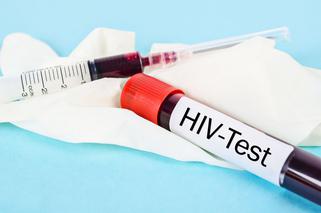 Test na HIV. Jak wygląda badanie na HIV i gdzie je wykonać?
