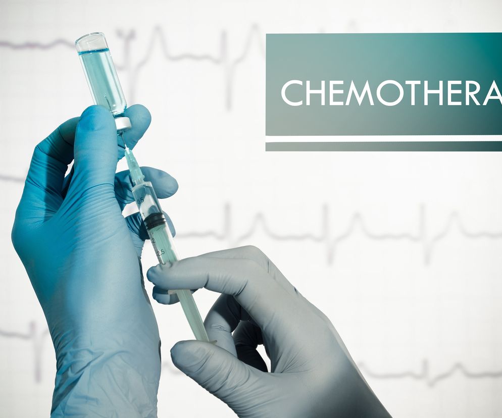 Jak się przygotować do chemioterapii - praktyczne rady