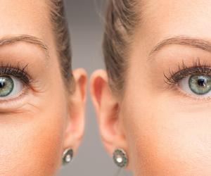 Już starożytni Grecy znali jego dobroczynne właściwości. Spłyci zmarszczki i zwalczy trądzik